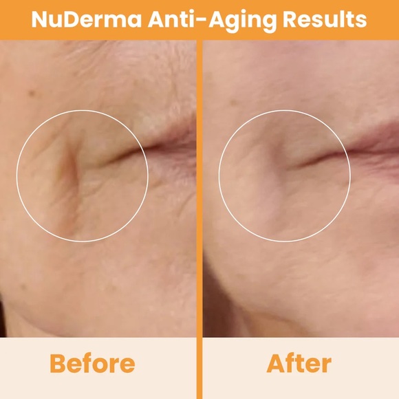 NuDerma Natural Dermal Cell Energy Amplification System - White - Picture 9 of 10